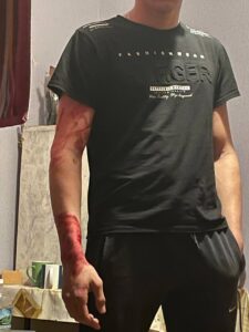 Поножовщина в общежитие